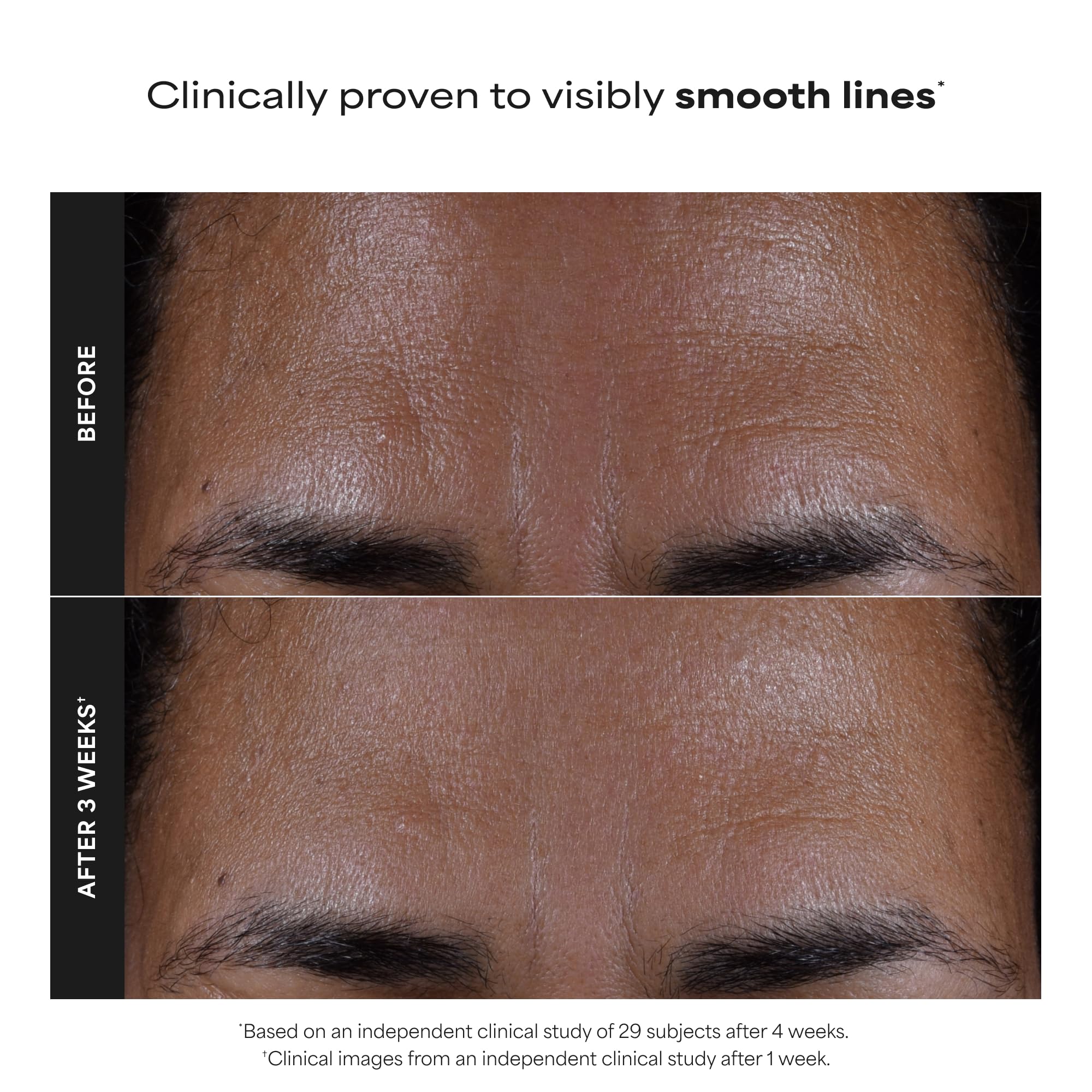 Paula's Choice SKIN PERFECTING 2% BHA Liquid Exfoliant thumbnail
